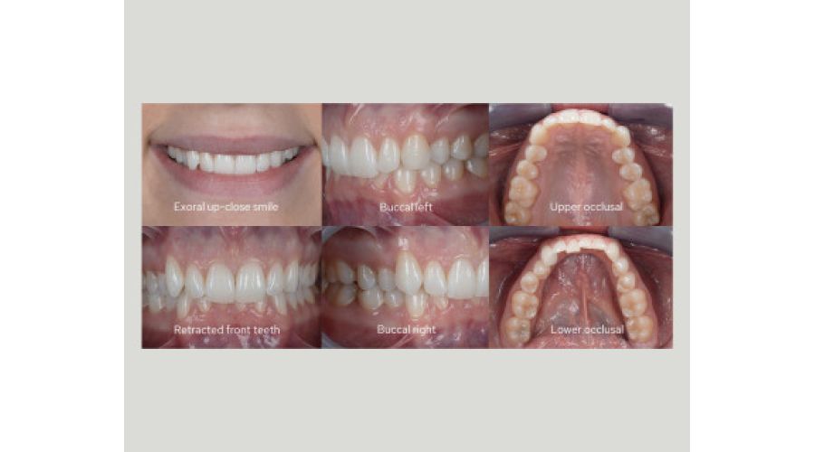 Godox MF12-DK2 Macro Flash- foto 7